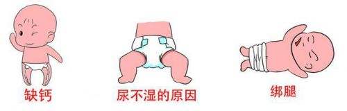 如何判断腿直不直,小孩腿不直怎么纠正腿型