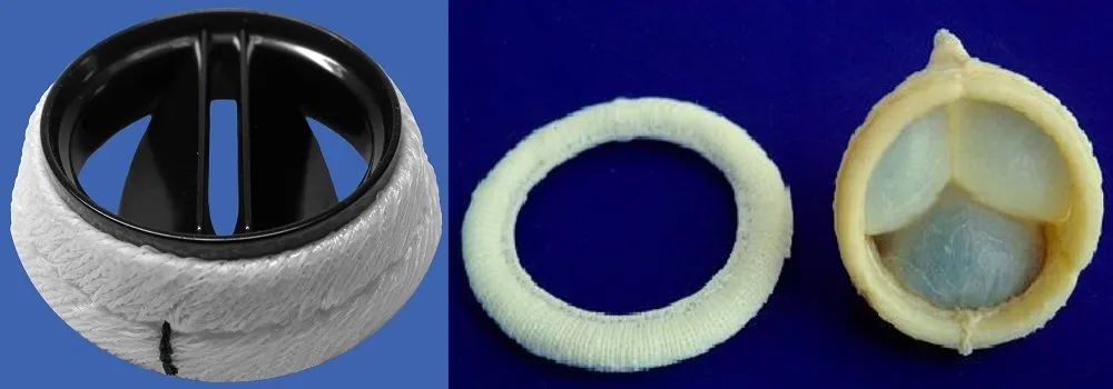 做完锥切和普通人一样吗,开胸手术的患者自述