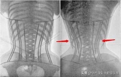 网红束腰真的很神奇吗,网红束腰神器靠不靠谱
