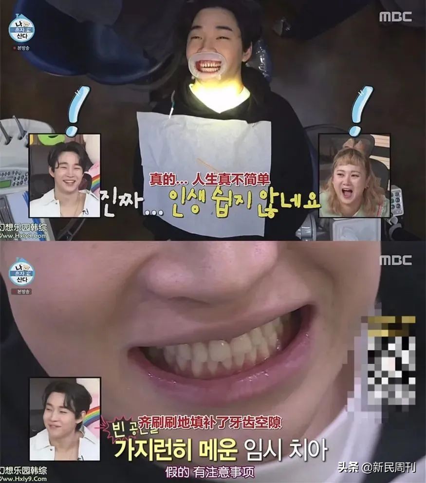 良医|明星们都在做烤瓷牙？但你最好别跟风