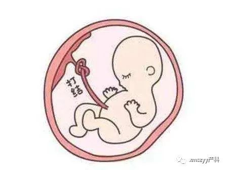 教你如何数胎动,怎么数胎动教你4个小方法