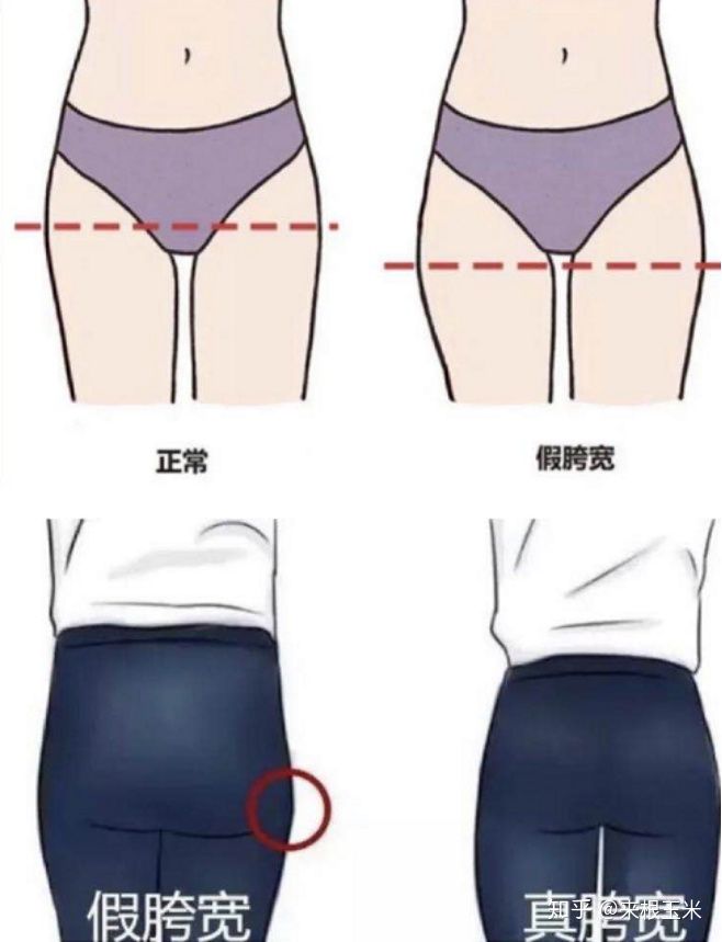 假胯宽、大象腿、脂肪腿,天生大粗腿的人该如何瘦大腿?