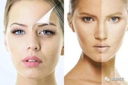 去除脸上黑色素最好最快的方法,男士去除脸上黑色素的最好方法