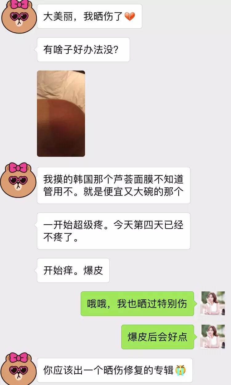被晒黑晒伤还能白过来吗,晒伤晒黑后要多久才能白回来