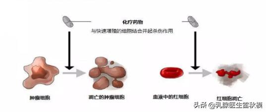 乳腺癌放疗前的那些事,乳腺癌化疗小知识