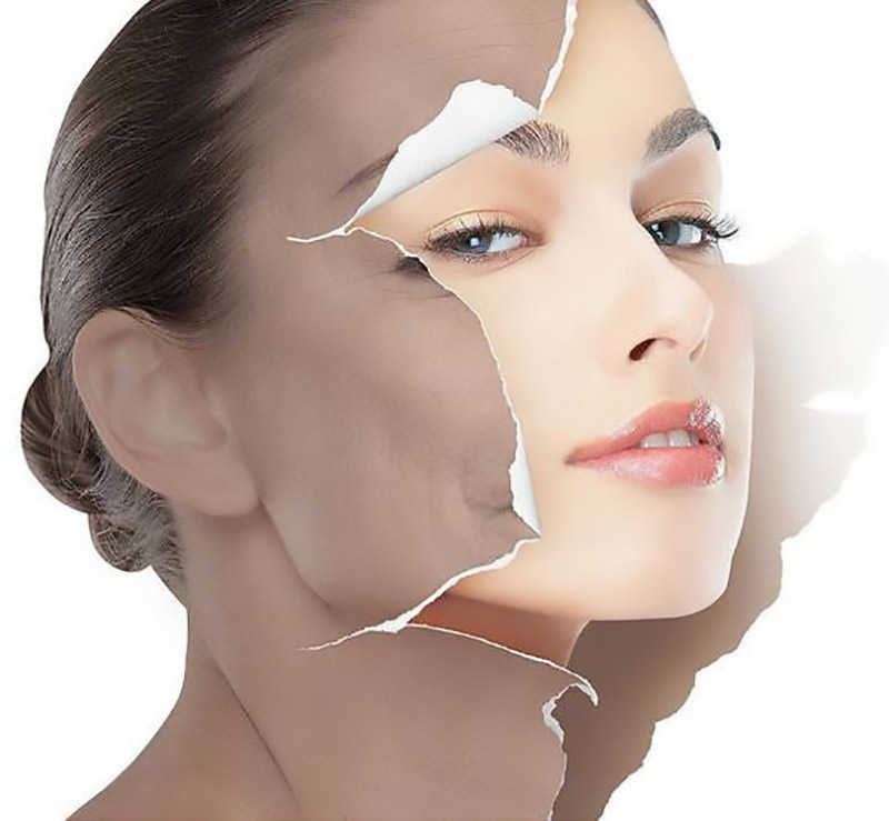 玻尿酸460亿身价,玻尿酸女王发家史