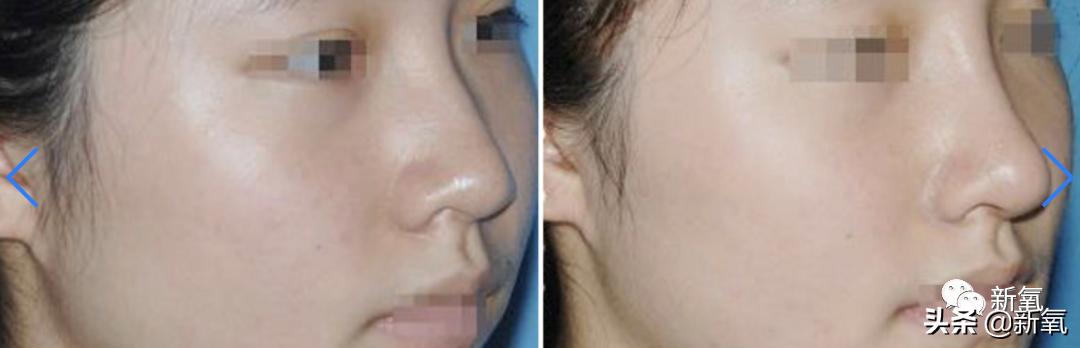 杨超越还能撑多久,杨超越遇到的真实事件