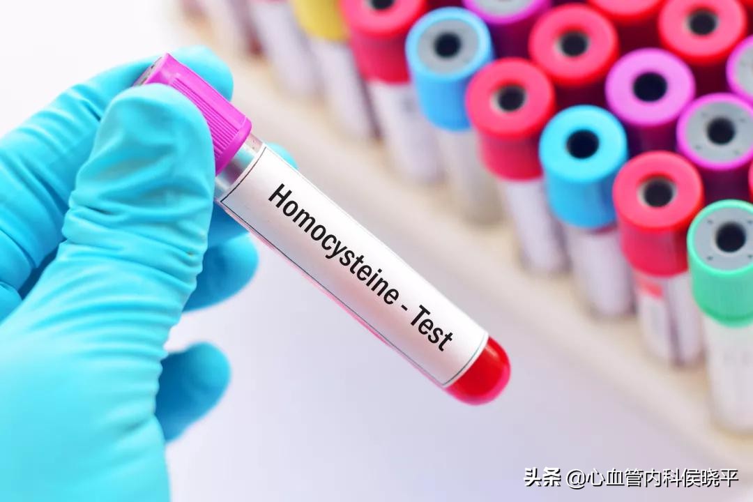 高血压补充叶酸的功效与作用,高血压同型半胱氨酸吃多少叶酸