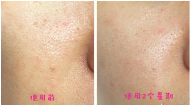 bobbibrown缩小毛孔精油,芭比波朗75号精油真能收缩毛孔吗