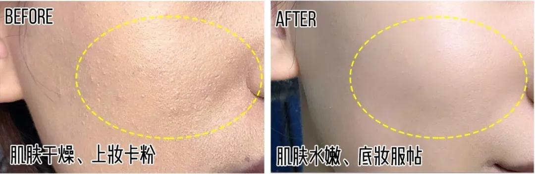 效果最好的熬夜面膜,去闭口熬夜最适合用的面膜