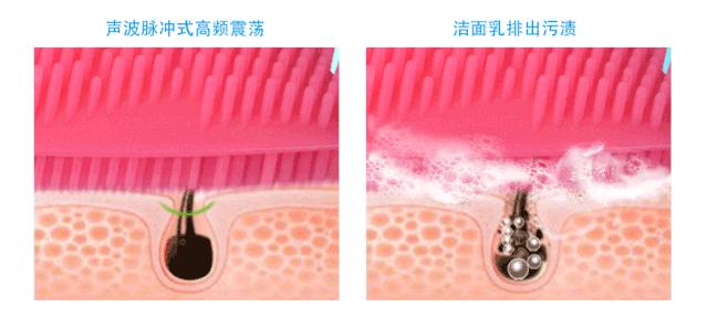 带你揭秘ReFa、Luna背后家用美容仪到底是「坑」还是「宝」?