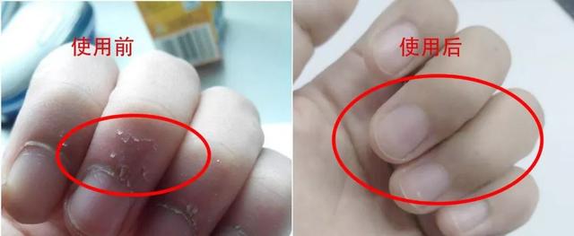 林志玲黄金,林志玲的价值