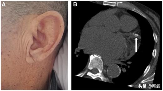 大s回应汪小菲婚内出轨传闻,大s开腔回应汪小菲出轨传闻