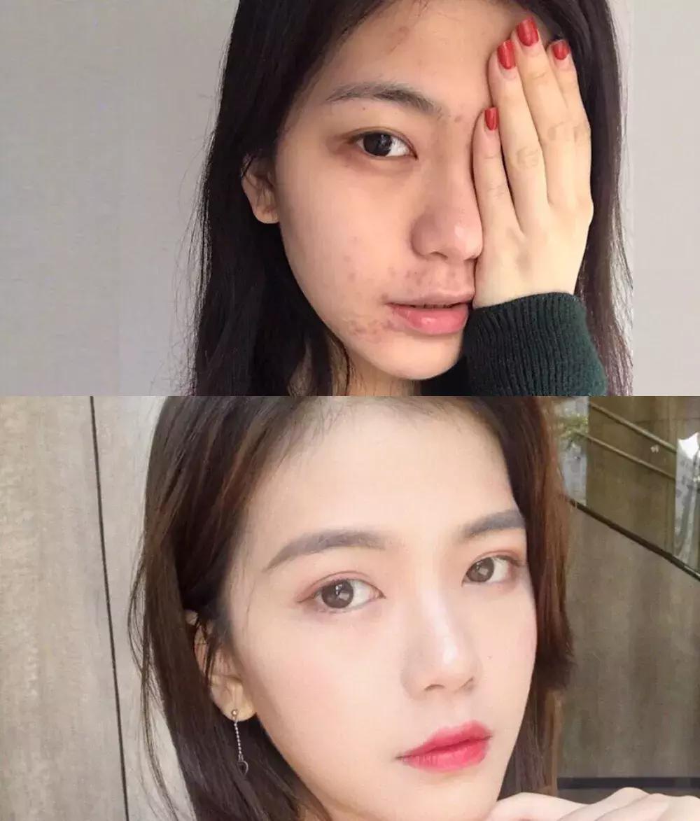 一到晚上皮肤暗沉发黄,一到下午皮肤暗沉