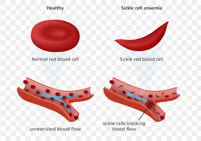 狗狗贫血缺钙怎么补最好,狗狗贫血严重除了输血还能怎么办