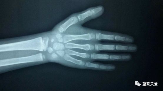 收藏未来价值,收藏未来