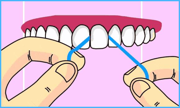填补牙缝防止塞牙,牙缝太大总塞牙怎么彻底解决