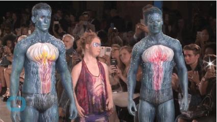 唐氏综合征中国美女,患有唐氏综合征的维密模特