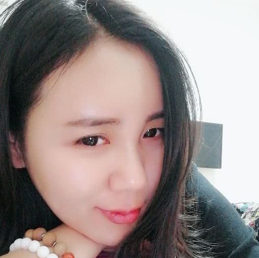 额头扁平怎么填充自然好看,额头颞部怎么填充好看