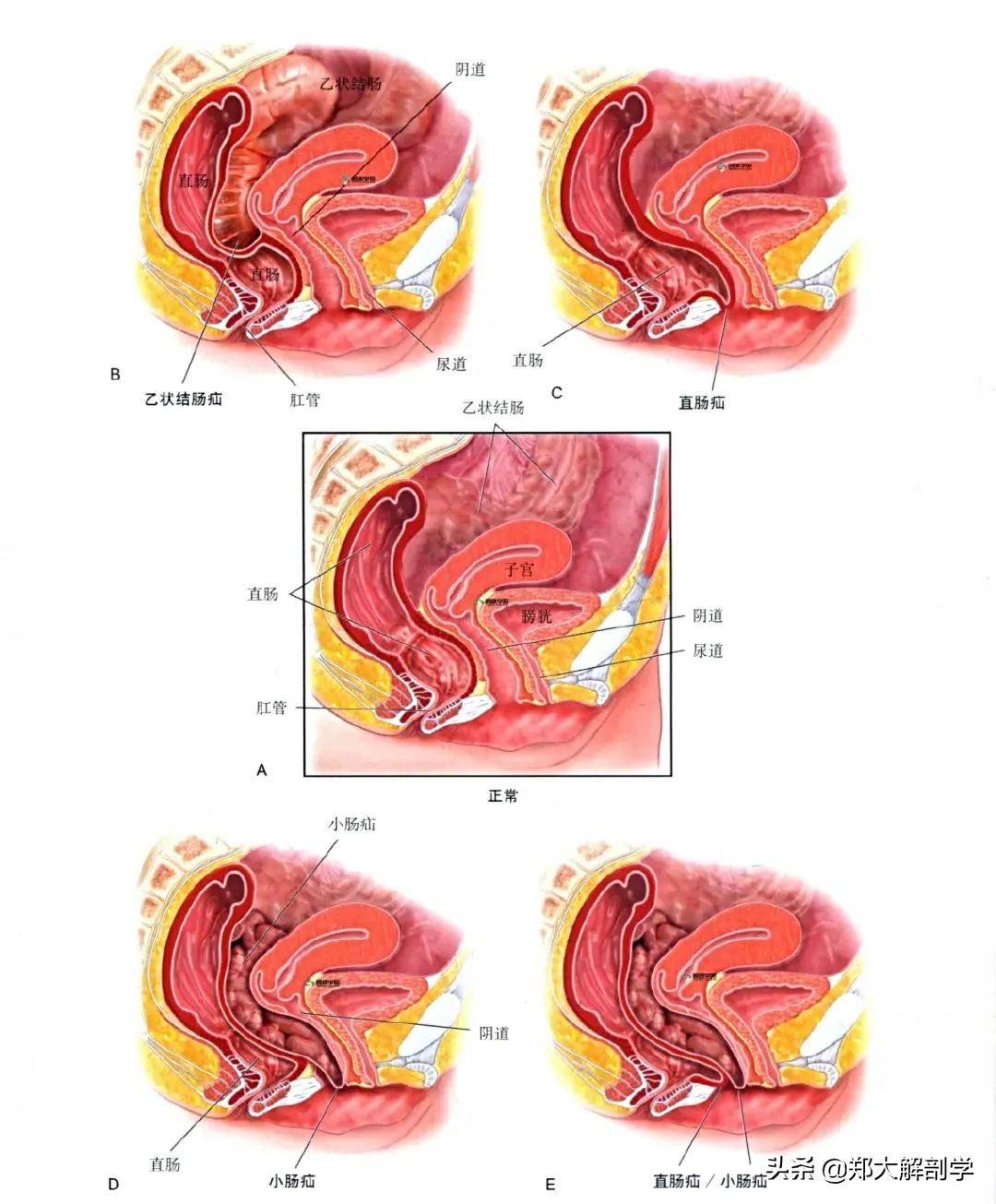 女性盆底功能障碍性疾病表现,南通治疗盆底功能障碍的医院