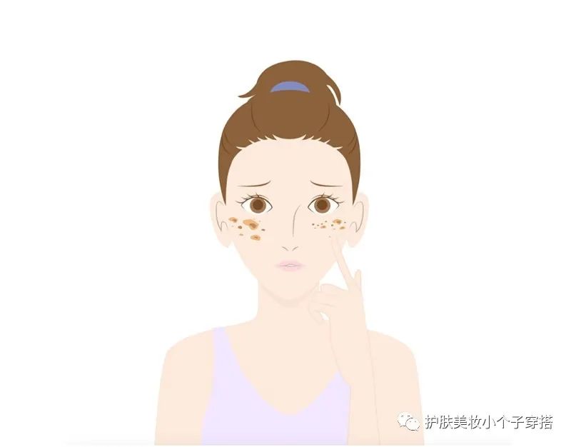 祛斑没有效果不要钱,祛斑没有皮损