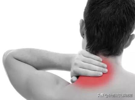 平衡针治落枕,治落枕扎针扎哪些穴位