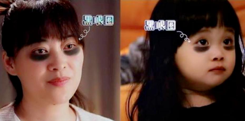 孕妇有黑眼圈会遗传给孩子吗,黑眼圈会遗传给孩子吗