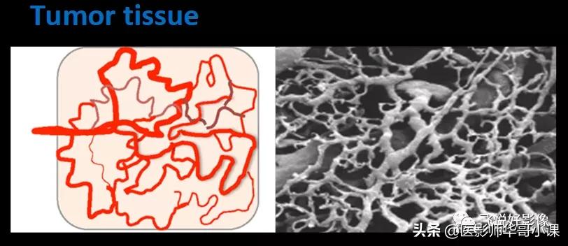 飞利浦磁共振系统界面及操作流程,飞利浦磁共振技术学习