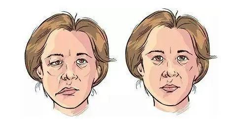 早春贪凉小心“毁容”，每天收治几十例！小小银针显神效