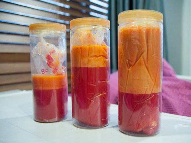 抽脂减肥和溶脂减肥的区别,溶脂与吸脂减肥的区别有哪些