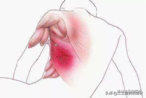 软组织产生疼痛,软组织疼痛比较好的治疗办法