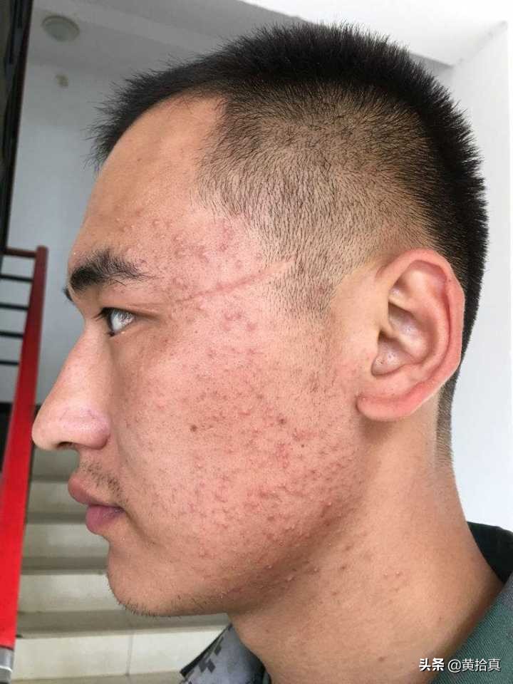 一个长得丑的男生,怎样才能全方位地变帅,改造自己?