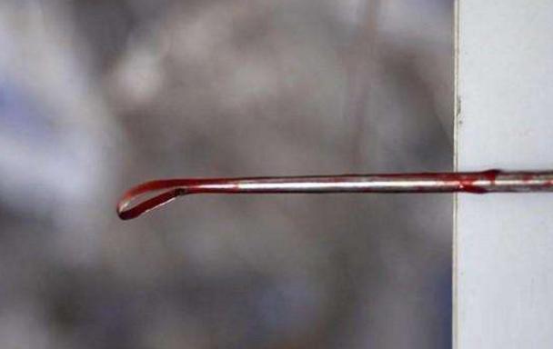 打掉一个月孩子有什么后遗症,女人第一胎打掉就不容易怀孕了吗