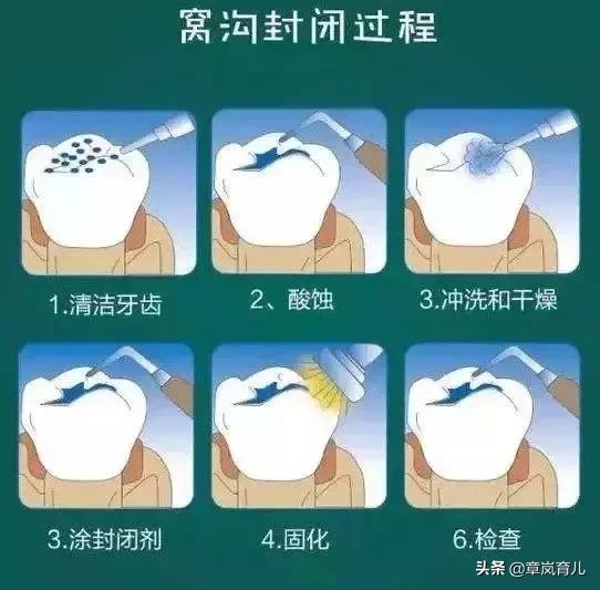 一排牙全拔了可以种牙嘛,牙齿拔光了多久可以种牙