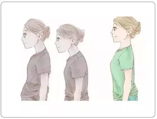 驼背怎么矫正扩胸,矫正胸型防驼背