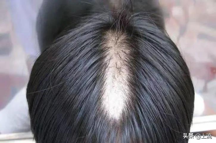 为什么总是忍不住拔倒刺,为什么会忍不住撕倒刺