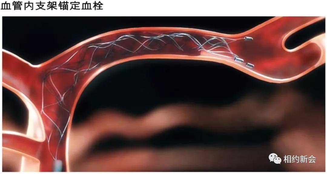 温县人民医院卒中中心,温县第二人民医院视频