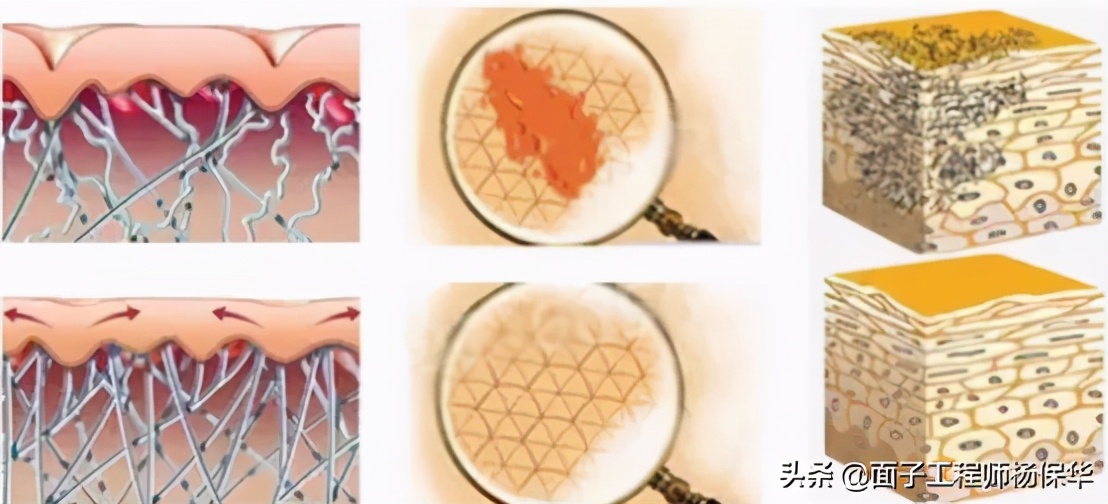 疤痕修复的6大误区医学科普,疤痕是在哪个阶段最好修复