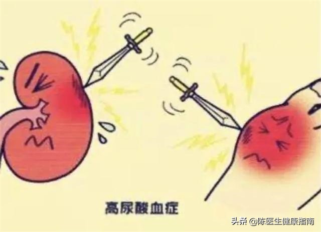 长期吃阿司匹林造成痛风怎么解决,服用阿司匹林肠溶片会引发痛风吗