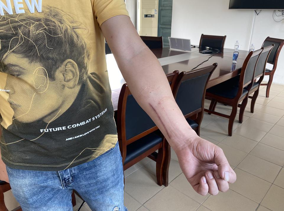 步步惊心网红桥男子事故,步步惊心吊桥男孩后续