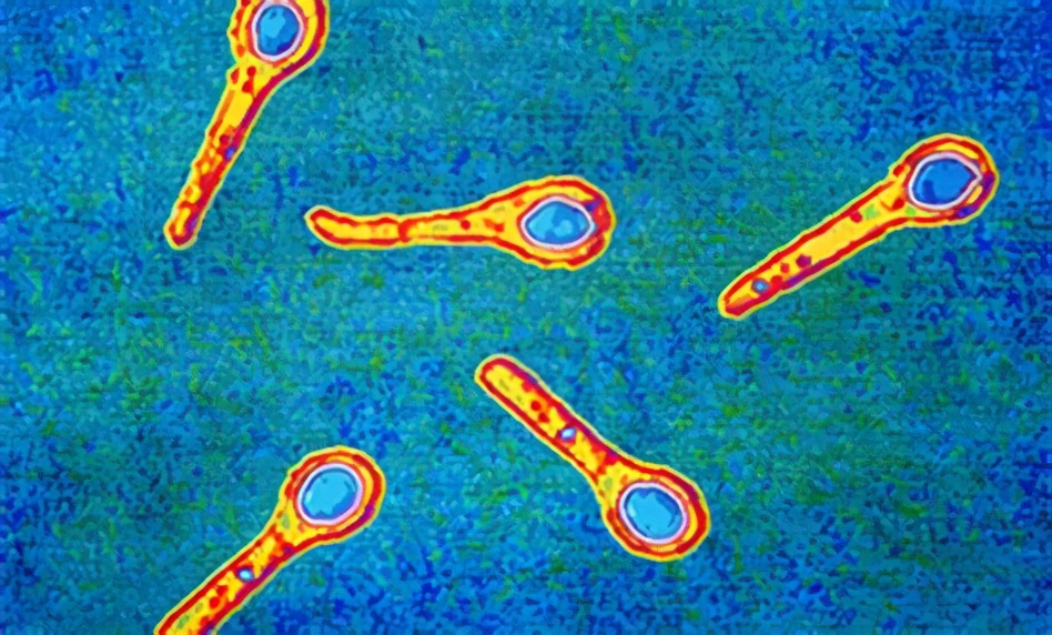 外伤处理后必须要打破伤风吗,受伤后为什么要打破伤风针