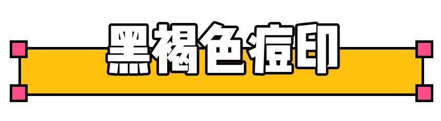 十大公认祛痘印效果最好的方法,教你几招祛痘印的最快方法