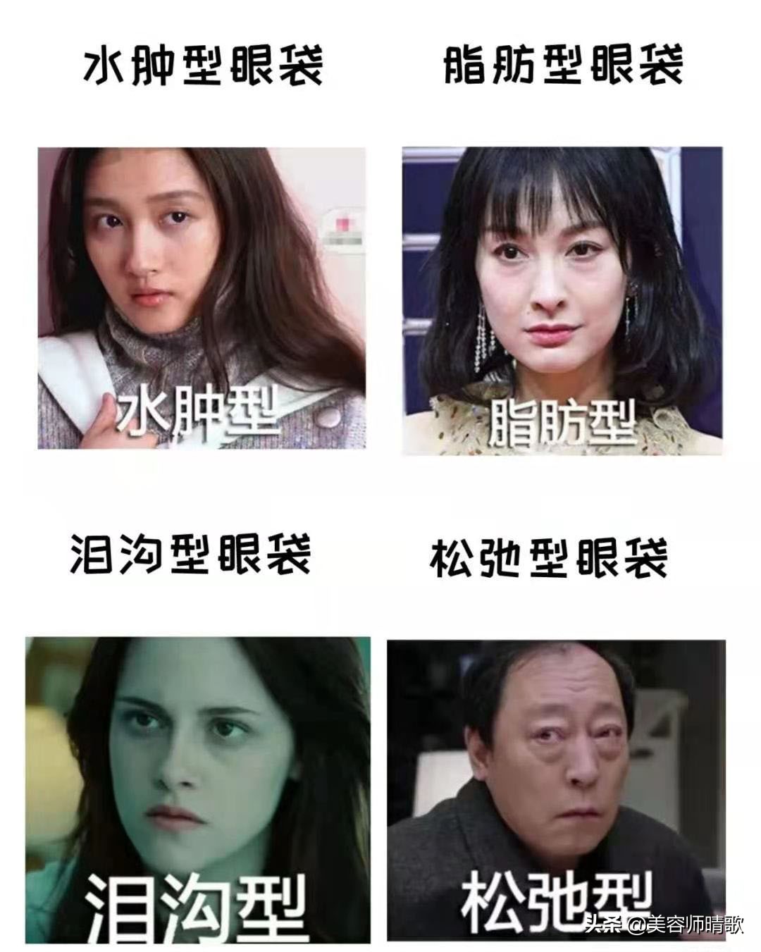 简单有效的去眼袋方法,眼袋好重秘方