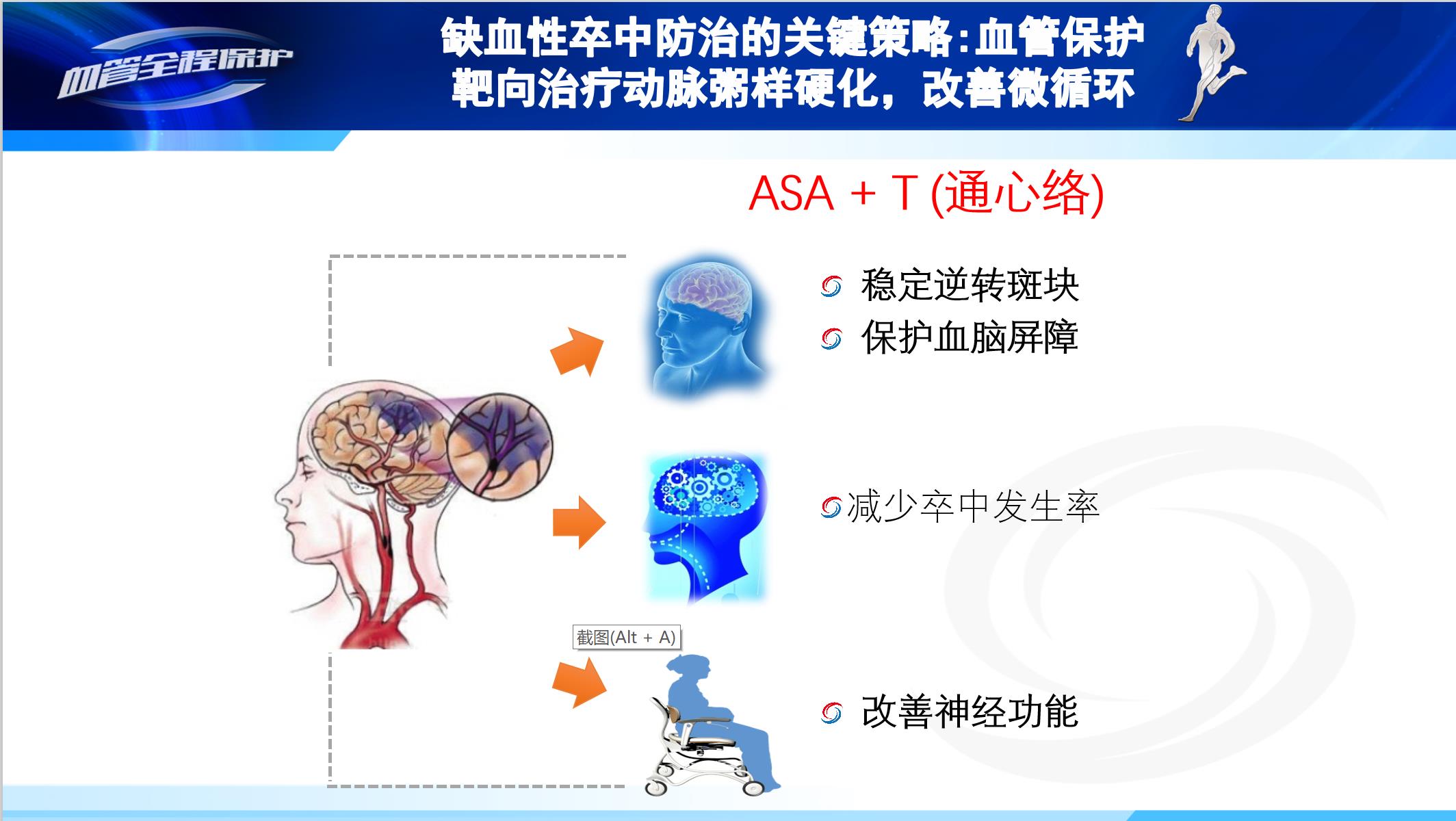 脑卒中介入治疗指南2018年,脑卒中国内外研究现状和发展趋势