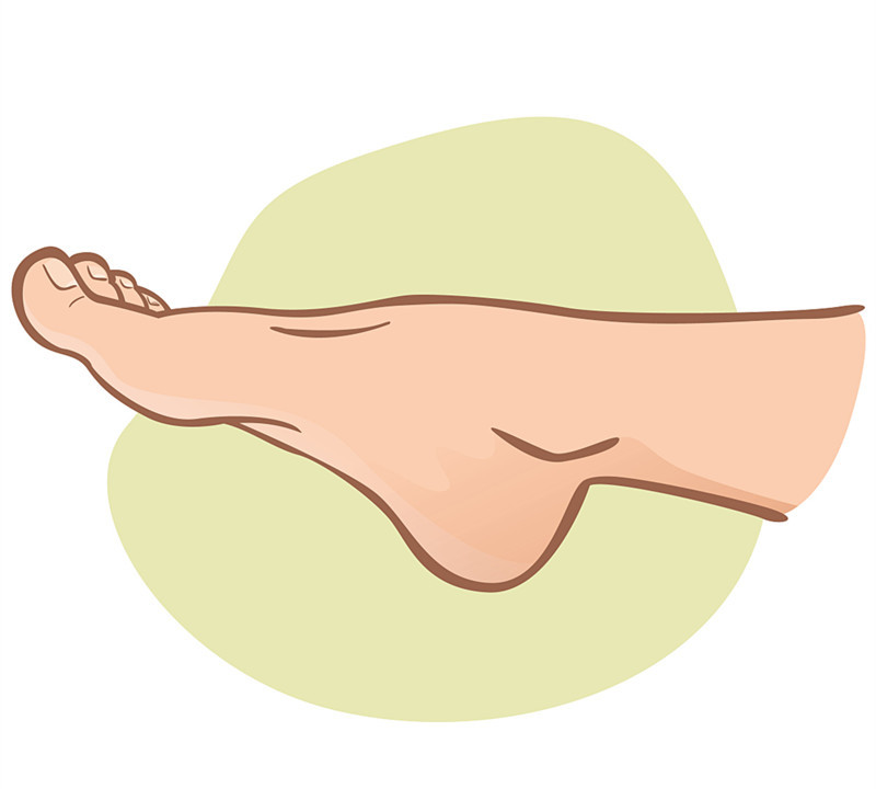 癣就是炎症引起的吗,癣是能治好吗