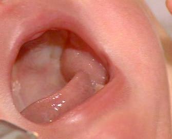 预防传染病的科普宣教,预防感染的科普小视频