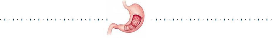 胃底腺息肉会癌变吗,胃底腺息肉是什么意思会癌变吗