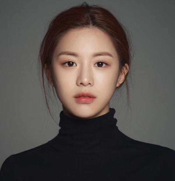 两点微创双眼皮是永久的吗,微创双眼皮术后眼角特别红