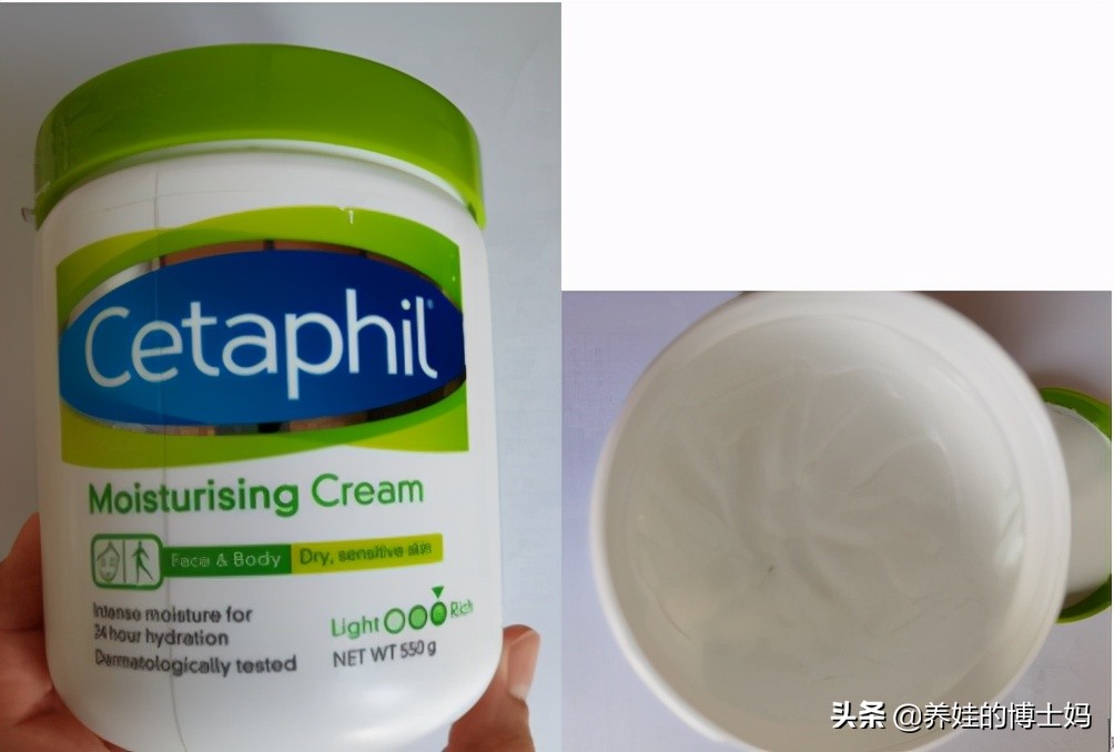 宝宝湿疹反反复复推荐一款保湿霜,湿疹攻坚战