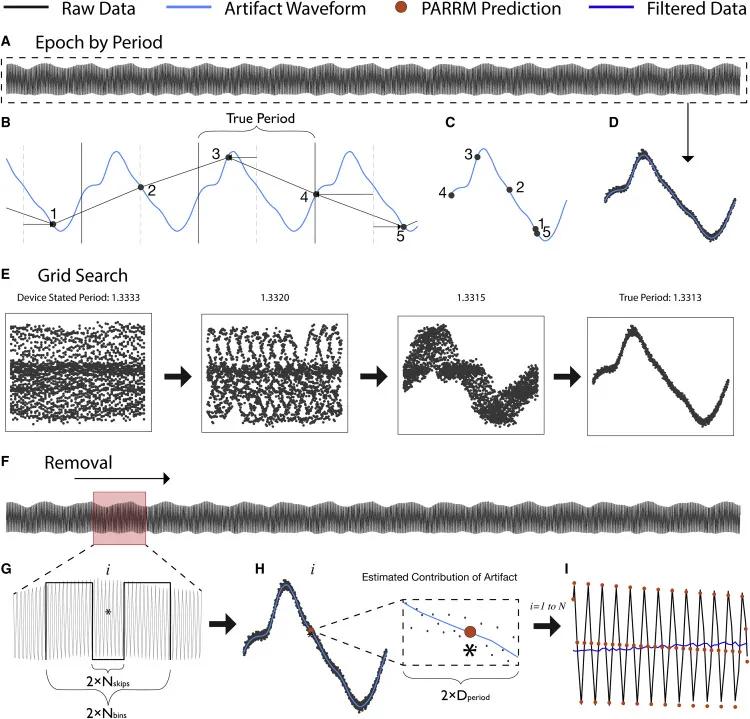 马斯克脑机接口实现治愈帕金森吗,布朗博士神器